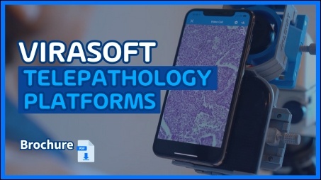 Telepathology Platforms